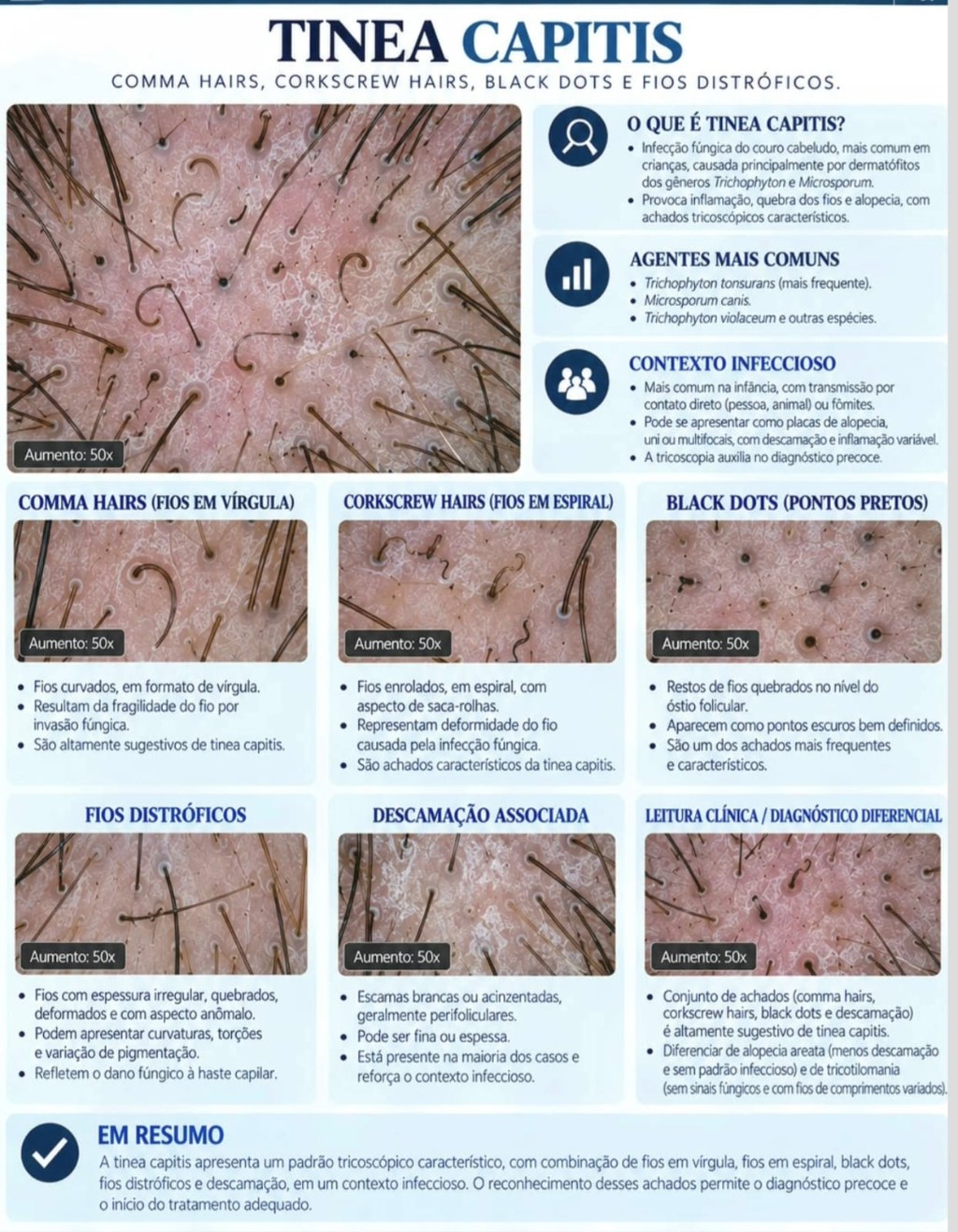 Tinea capitis