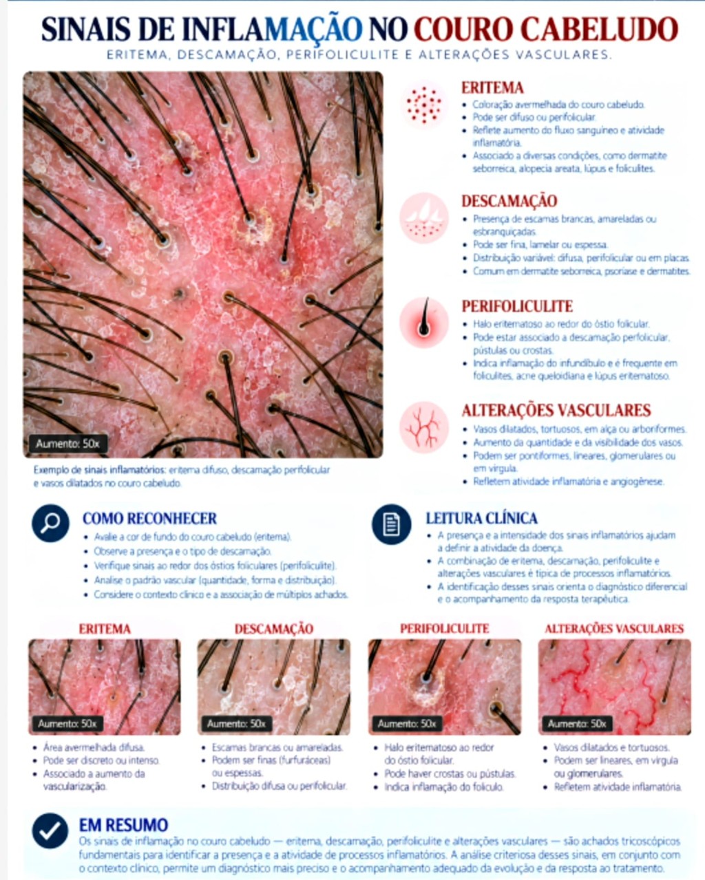 Sinais de inflama&ccedil;&atilde;o no couro cabeludo