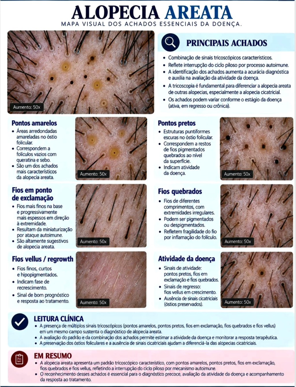 Alopecia areata