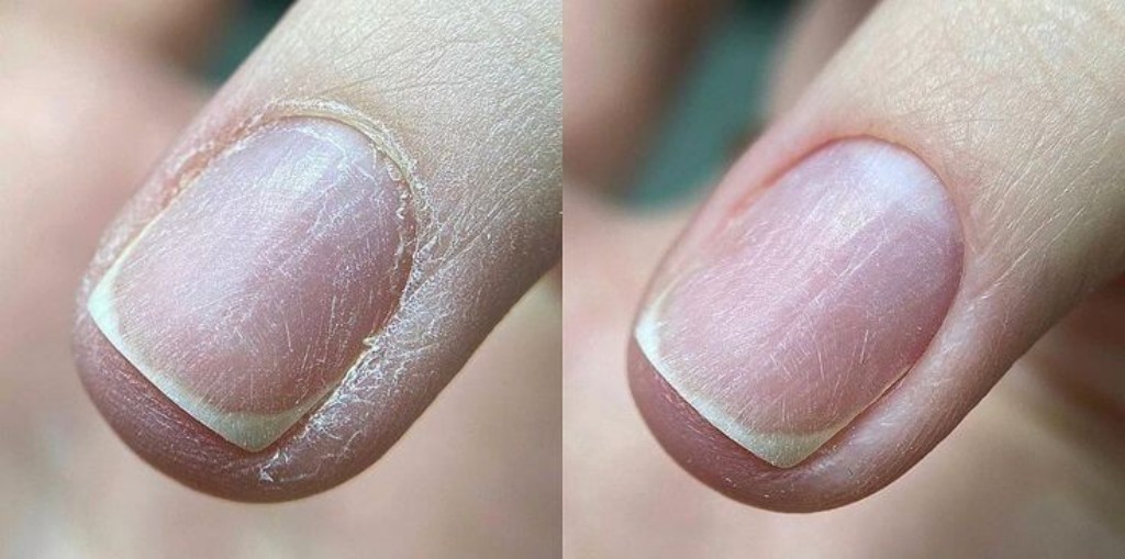 Preparaci&oacute;n de la u&ntilde;a natural con buffer para matizar la superficie antes de aplicar semipermanente