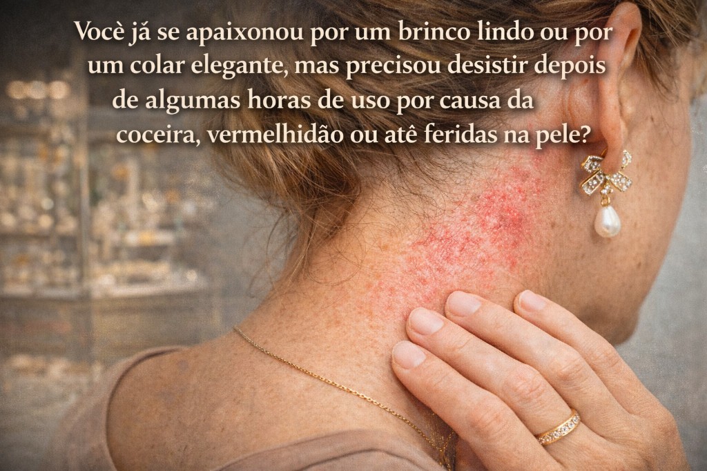 saiba que a alergia a metais &eacute; muito mais comum do que parece 