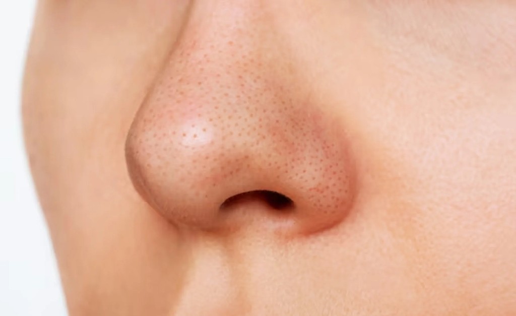 ¿Cómo eliminar puntos negros en la nariz?