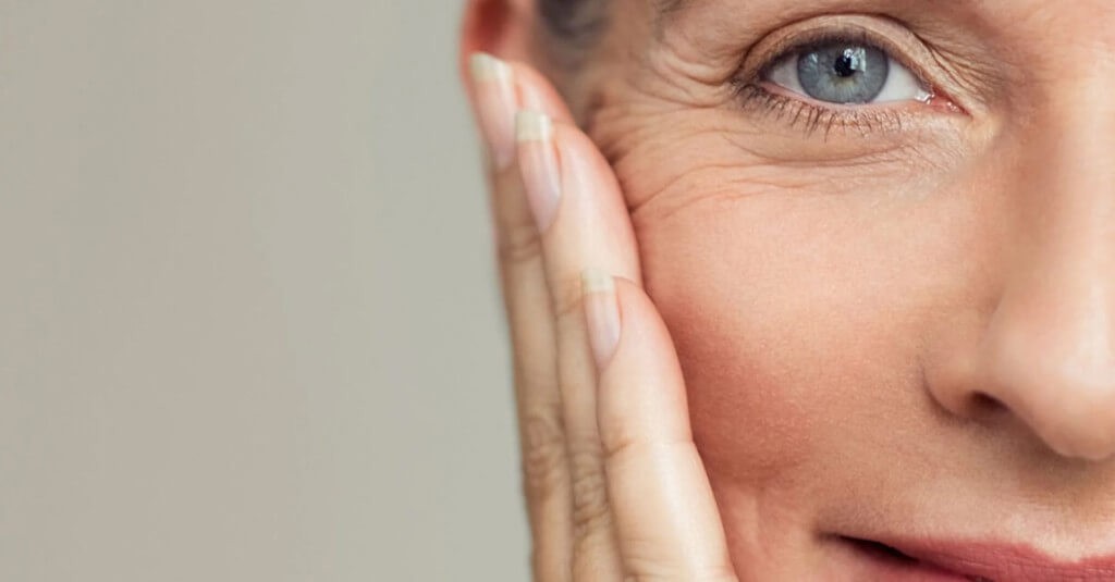 ¿Cómo disminuir arrugas en la cara?