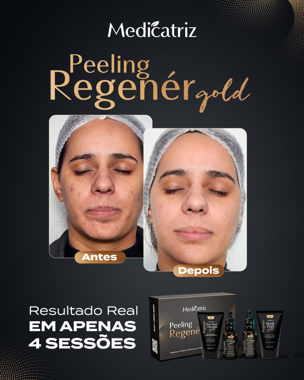 Peeling Regener Gold Medicatriz