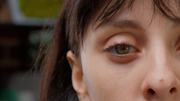 criança de olhos claros estão mais sujeitas a problemas oculares