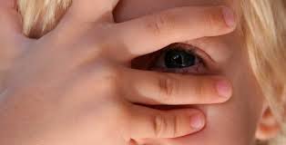 lesão ocular em crianças - blog sunkids