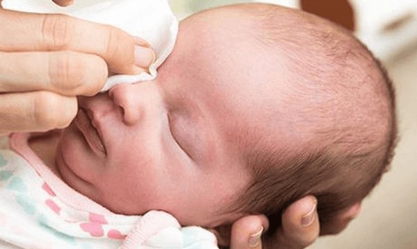 cuidados com a coceira nos olhos do bebê