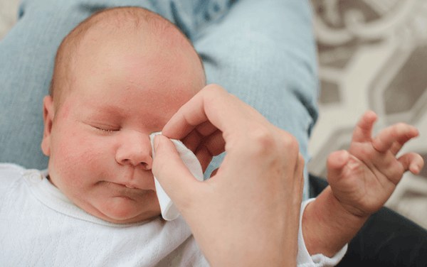Conjuntivite bacteriana em bebês