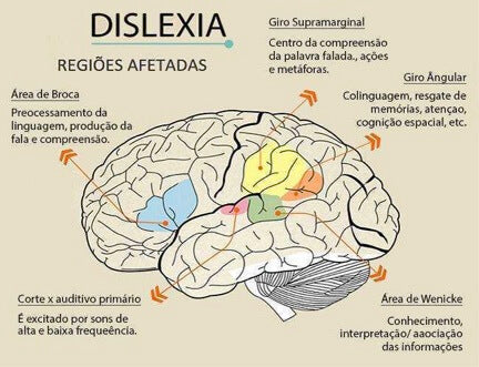 dislexia - o que é