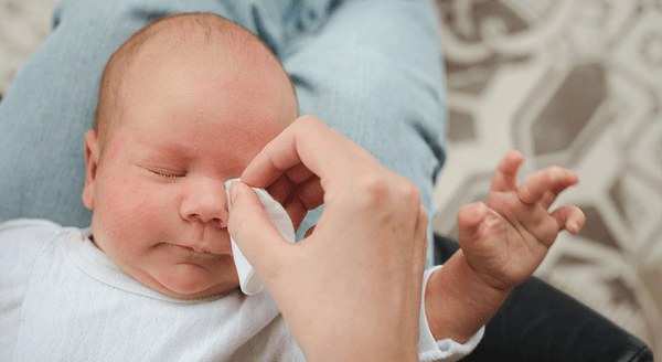 como tratar a conjuntivite do bebe