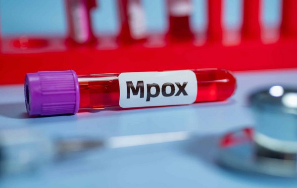 mpox risco para crianças
