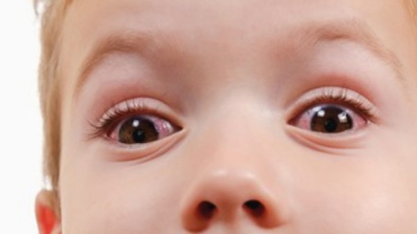 meu filho reclama de dor no olho, o que pode ser?